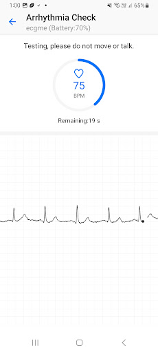 Heart Health - ecgme Screen 2
