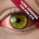 Cover Image of 下载 Home Remedies For Pink Eye - C  APK