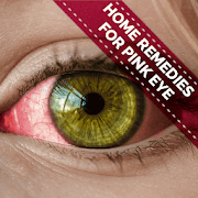 Home Remedies For Pink Eye - Conjunctivitis