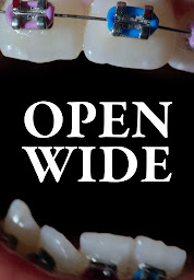 「Open Wide」圖示圖片