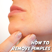 How to Remove Pimples
