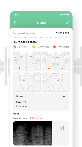 ChestPal Pro Screen 3