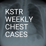 Cover Image of डाउनलोड KSTR Weekly Chest Cases  APK