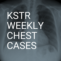 KSTR Weekly Chest Cases