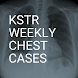 KSTR Weekly Chest Cases - Androidアプリ