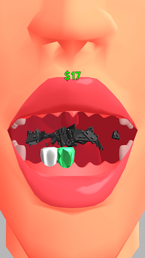 Merge Teeth Screen 2