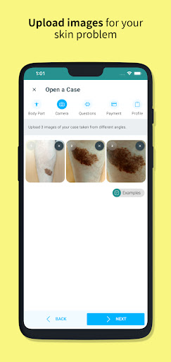 Skin Check: Dermatology App Screen 3