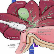 Ultrasound Of Gallbladder