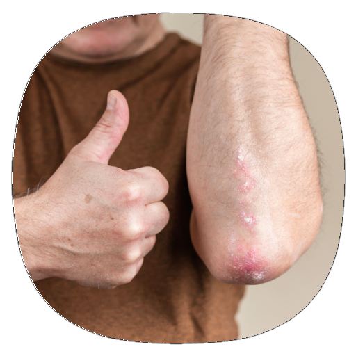 How to Crack Your Elbow logo