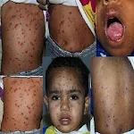 Cover Image of Baixar Atlas de Dermatologia e Infecções da Pele  APK