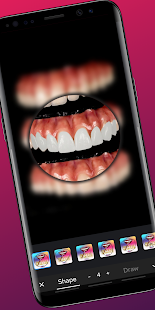 צילום מסך של מעצב שיניים