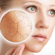 Skin Care Diseases & Treatment - Androidアプリ
