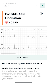 KardiaMobile EKG Monitor - Instant EKG on Your Phone