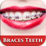 Beauty Brace Teeth Camera icon