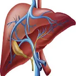 Liver Cirrhosis Apk
