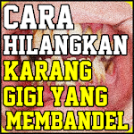 Cover Image of Download Cara Menghilangkan Karang Gigi  APK