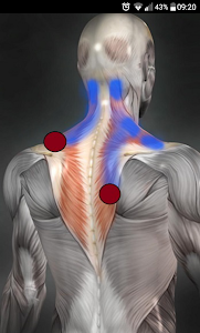 Trigger Points Unknown