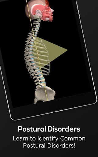 Screenshot of Posture by Muscle & Motion
