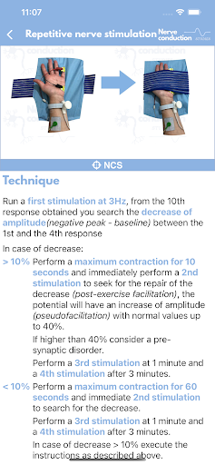 Nerve Conduction Studies Screen 3
