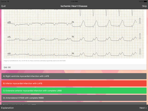 ECG Master Quiz and Practice