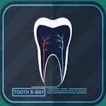 asnan scan - اسنان اسكان