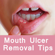 Top 43 Health & Fitness Apps Like Mouth Ulcer Removal Tips - मुँह के छाले मिटाये - Best Alternatives