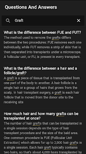 Hair Transplant Guide