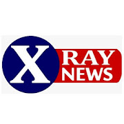 x-RAY NEWS