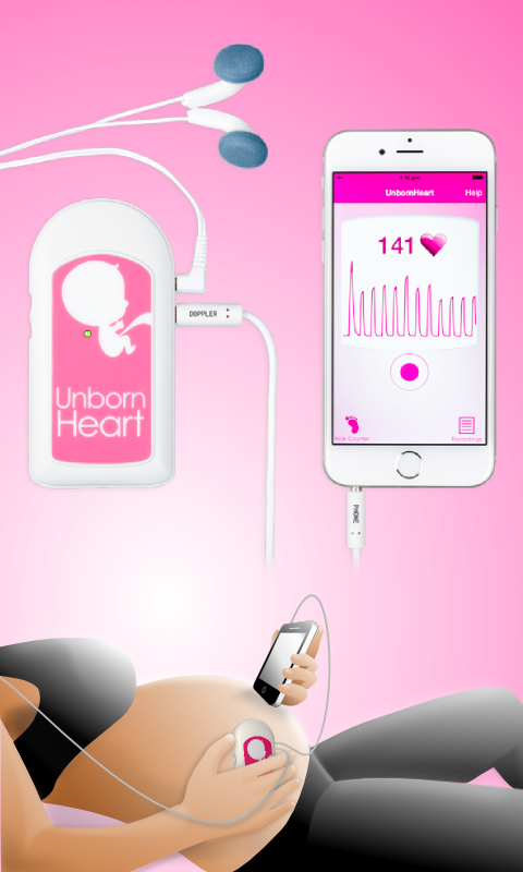 Fetal Doppler UnbornHeartのおすすめ画像1