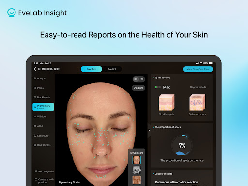 EveLab Insight Eve M Screen 3