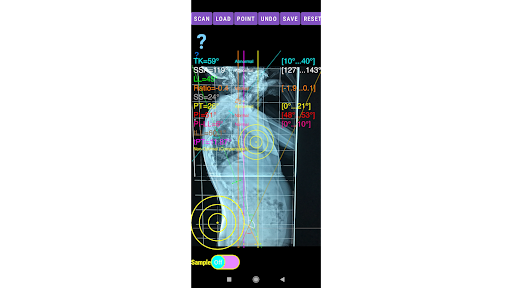 Sagittal Balance App screenshot 21
