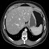 abdominal CT: annotated slices
