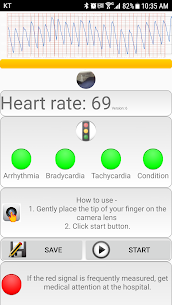 Free Cardiac diagnosis (heart rate, arrhythmia) 2022 5