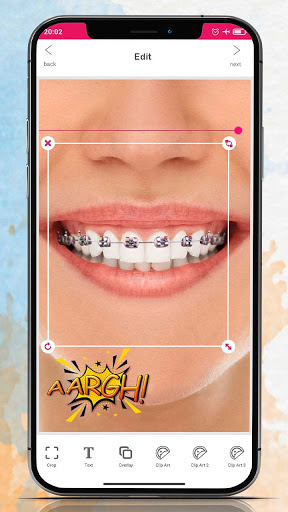 Braces Camera Editor Screen 2