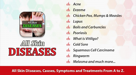 All Skin Diseases & Treatment Unknown