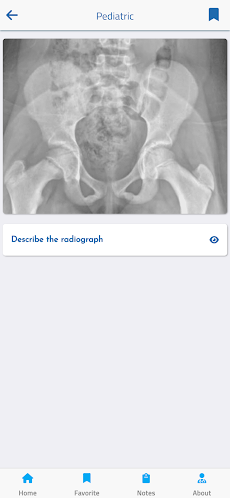 Orthopedic FRCS VIVAs Appのおすすめ画像5
