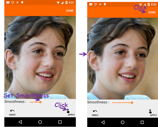 Face Acne Remover Photo Editor Screen 3