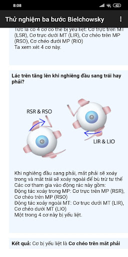 Thử nghiệm ba bước Bielchowsky