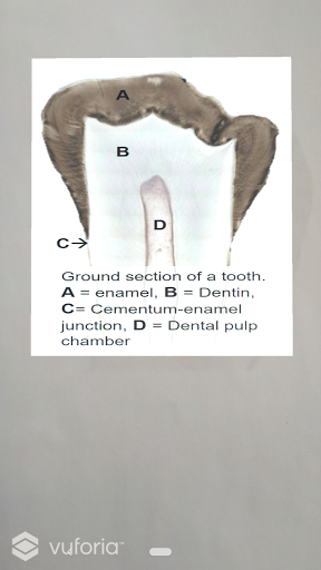 Dental AR Screen 3