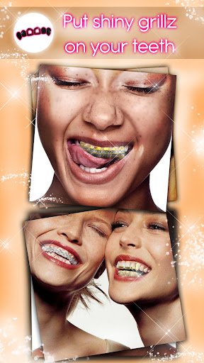 Braces Teeth Photo Editor Screen 2