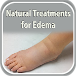 Cover Image of डाउनलोड Natural Treatments for Edema  APK