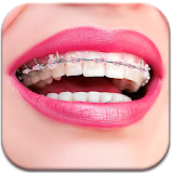 Real Sweet Braces booth Camera icon