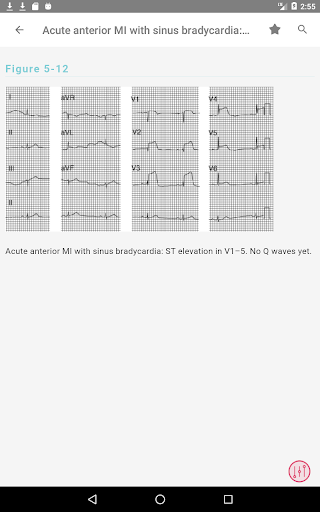 Swanton's Cardiology Guide 11