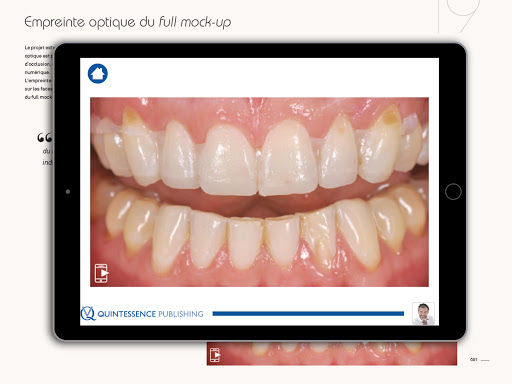 Quintessence Koubi Screen 2