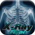X-ray filter for photos1.0