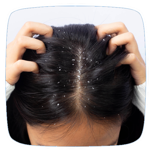 How To Get Rid Of Dandruff logo