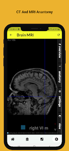 Radiology Anatomy CT And MRI