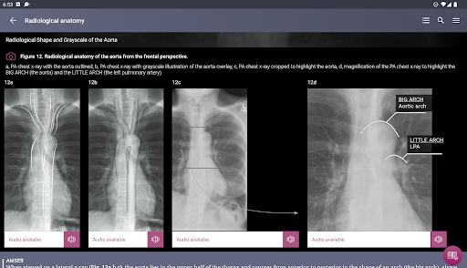 Chest X-Ray Interpretation screenshot 18