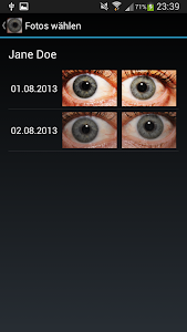 Eye Diagnosis Unknown