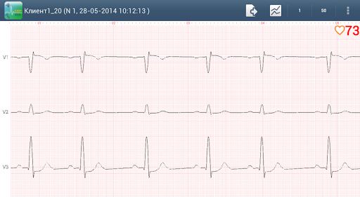 Easy ECG Mobile PRO Screen 3